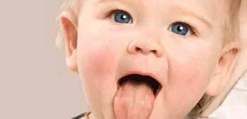 Bebeklerde Bademcik Belirtileri ve Tedavisi